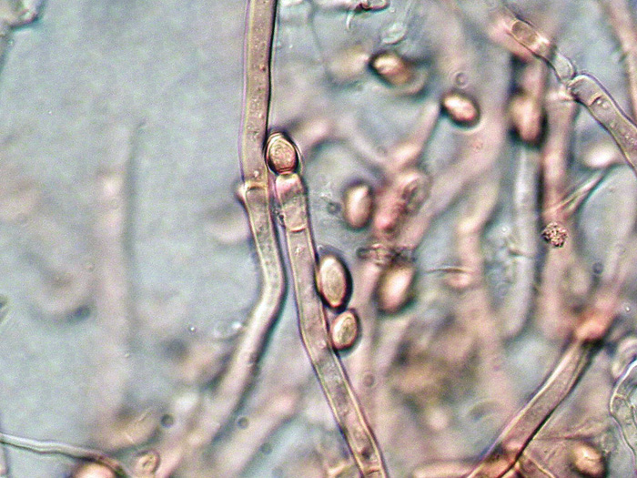 Haplotrichum da determinare